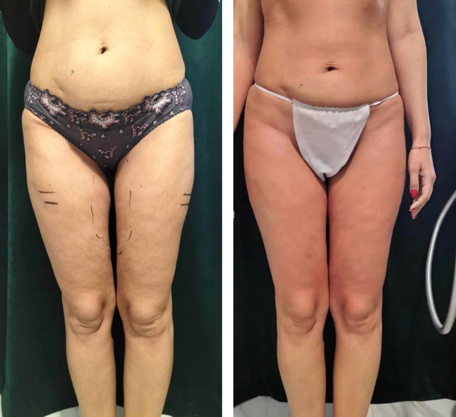 WhatsApp Image 2025-11-18 at 19.44.31 (4)