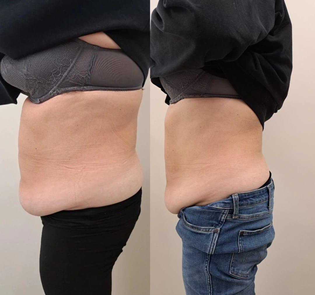 WhatsApp Image 2025-11-18 at 19.44.31